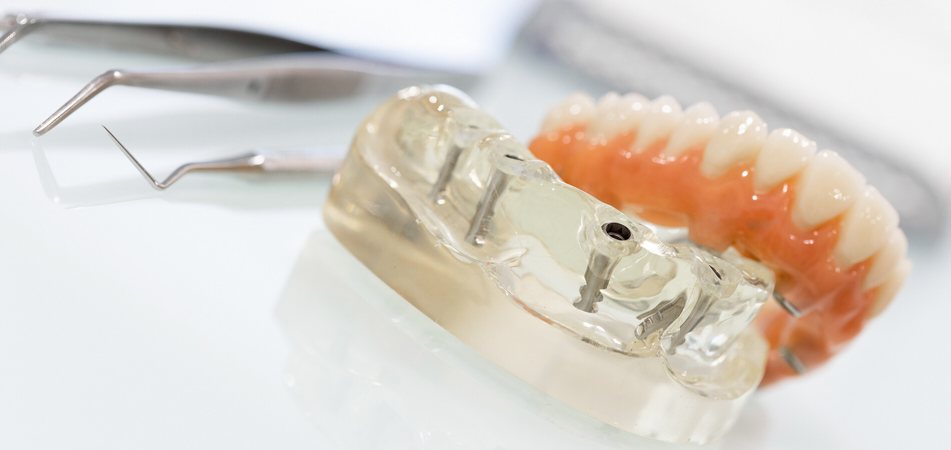 Zahnersatz in der Zahnarztpraxis in München Giesing